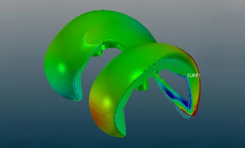Knee implant point cloud digital twin