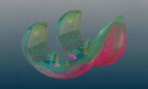 Knee point cloud